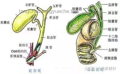 **長(zhǎng)期夜班與膽囊結(jié)石風(fēng)險(xiǎn)：一女子10年夜班生活與95顆結(jié)石的警示**