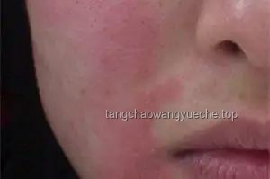 第二屆小動(dòng)物皮膚病論壇過敏主題實(shí)戰(zhàn)指南：4位專家共解臨床診療難題