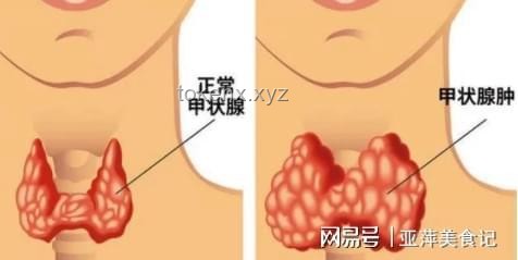 **每一次怒氣，都是對(duì)甲狀腺的隱形傷害??**