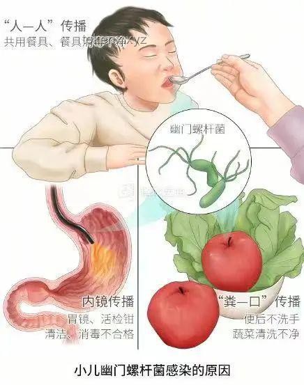 “這個(gè)細(xì)菌一人感染全家都得查”——幽門螺桿菌家庭感染案例研究