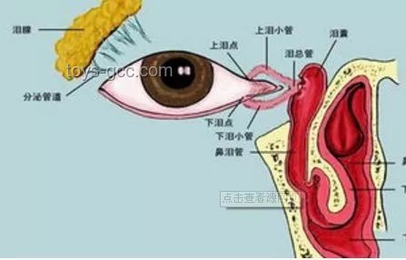 **淚囊異常癥狀對(duì)比：女子右眼狂飆淚與常見(jiàn)淚道疾病**