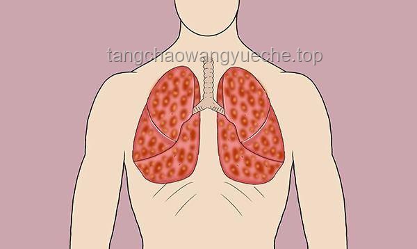 烏龜誤死被當(dāng)肥料埋2個(gè)月后復(fù)活：全面解決方案與預(yù)防措施