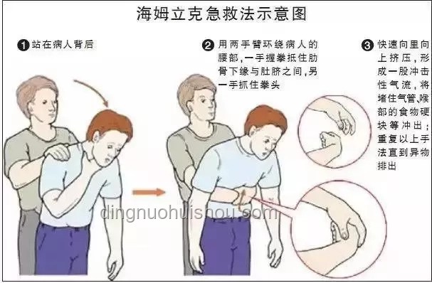 **不小心滑倒后的自救與裝逼技巧：烏龍絞柱動作解析與防范策略**