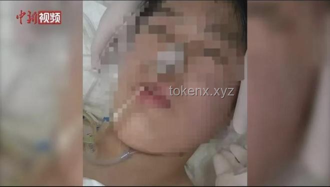 湖北17歲女孩腦死亡奇跡生還案例研究
