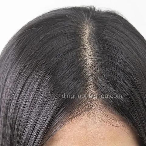 洗頭后不良習慣加劇脫發(fā)問題洞察