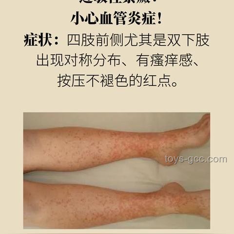 小紅點(diǎn)探秘：用AI+醫(yī)療新視角，解鎖癌變謎團(tuán)