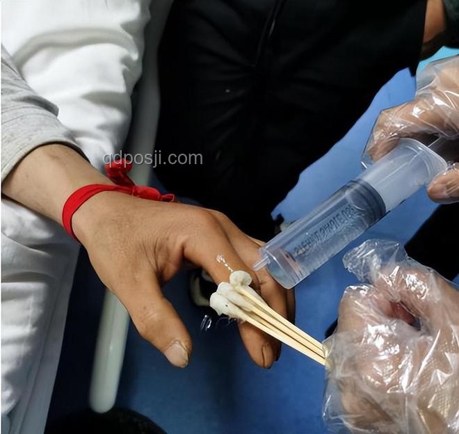 被蛇咬后應(yīng)急處理指南