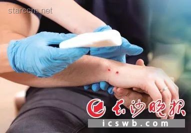 男子被蝮蛇咬傷全市無適配血清解決方案