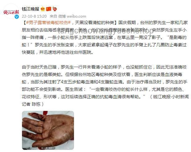 男子被蝮蛇咬傷全市尋適配血清案研究