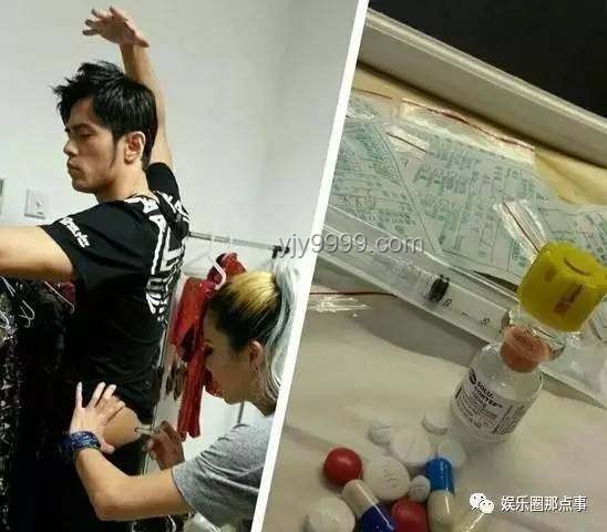 周杰倫健康狀況對(duì)比：強(qiáng)直性脊柱炎疑似加重分析