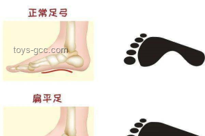 “踩屎感”鞋未來趨勢：健康隱患引發(fā)消費變革