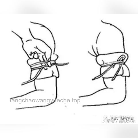 疑被蛇咬身亡事件背后的醫(yī)療與責任知識