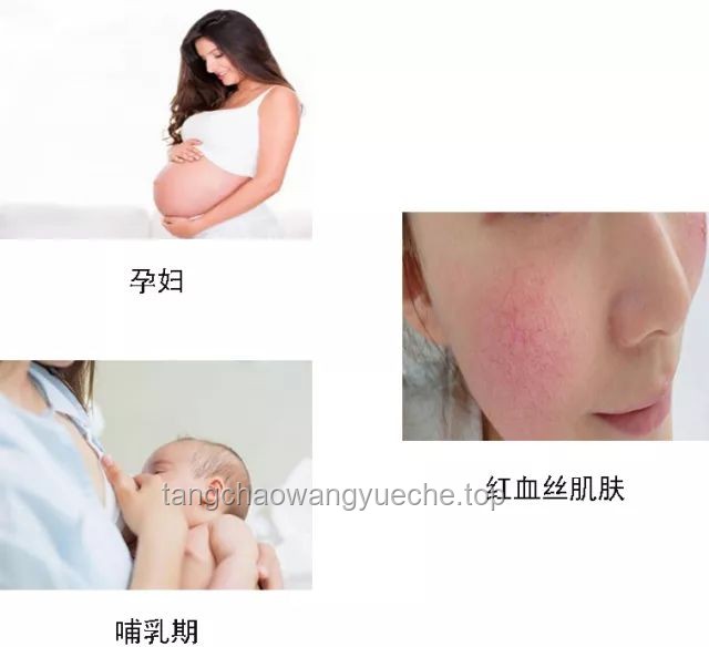 Labubu牙套佩戴與護(hù)理指南：輕松掌握，美麗加分