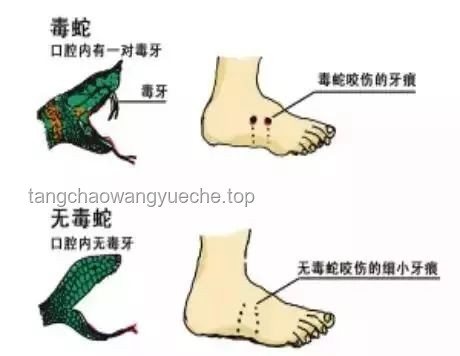 毒蛇咬傷啟示錄：跨界救援與應(yīng)急創(chuàng)新