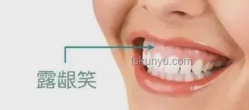 韋神牙周炎治療：口腔健康新趨勢(shì)預(yù)測(cè)