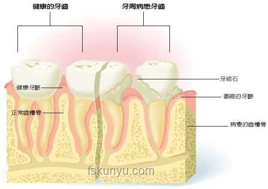 韋神牙周炎治療：口腔健康新趨勢(shì)預(yù)測(cè)