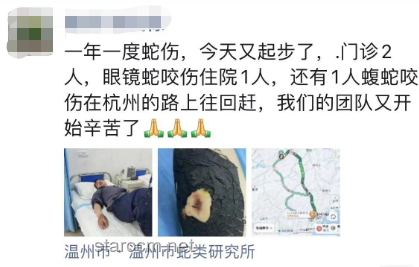 女生河邊散步遇蝮蛇咬傷處理指南