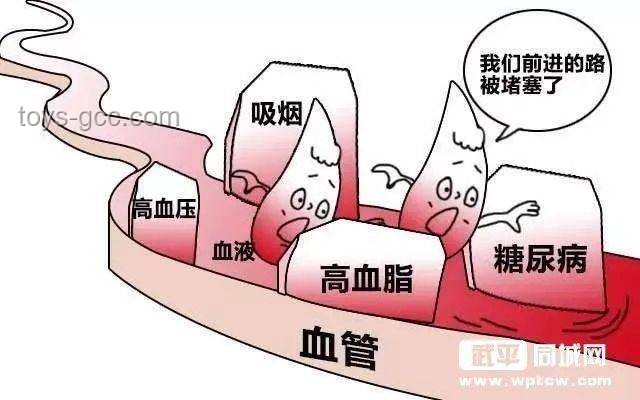 34歲網(wǎng)紅村花突發(fā)腦梗警示，了解腦梗知識很重要