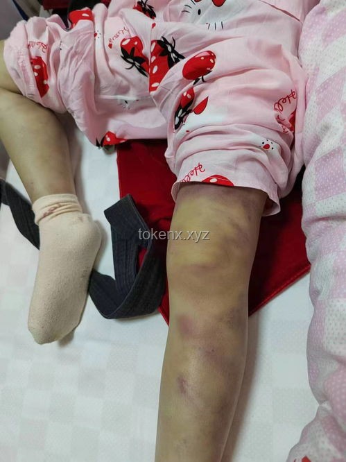 3歲女童被虐致死案一審二審對(duì)比分析