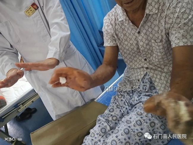 三亞被咬女子案：了解神經(jīng)毒蛇咬傷知識