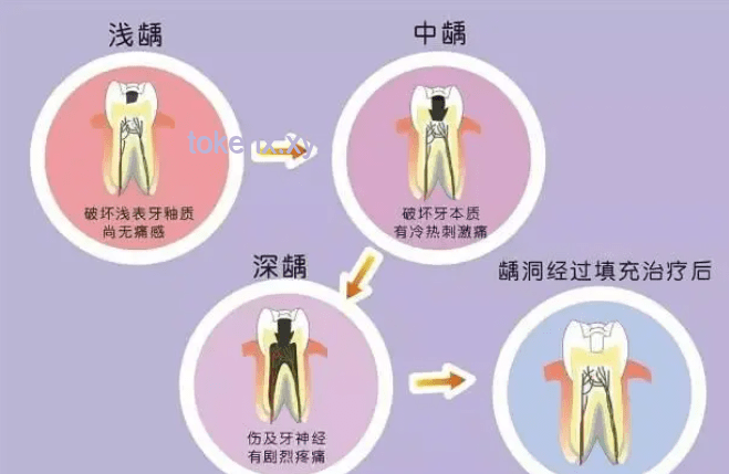 牙醫(yī)預(yù)警與韋東奕牙周危機(jī)：從預(yù)防到治療的對(duì)比分析