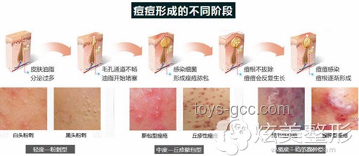 韋神門牙脫落原因及治療方案對比分析