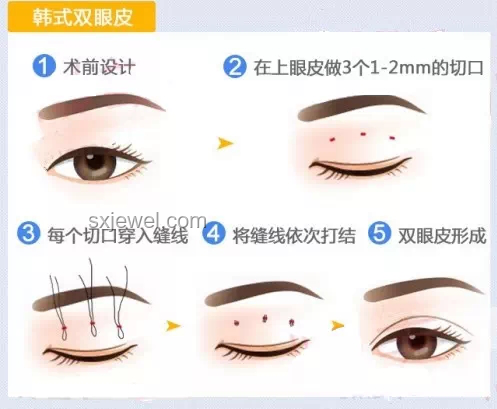 王安宇眼睛問題解決方案：改善視力與眼部健康
