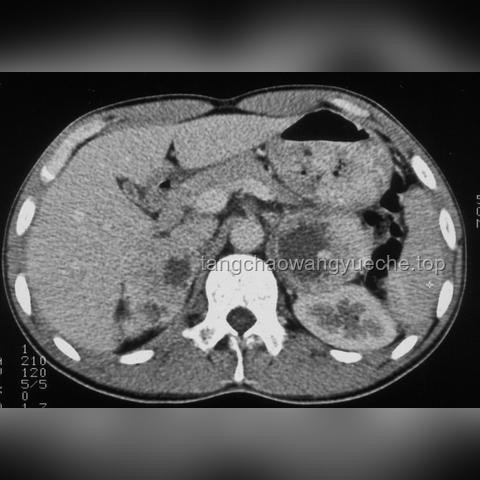 甲狀腺健康3大積極表現(xiàn)對比分析