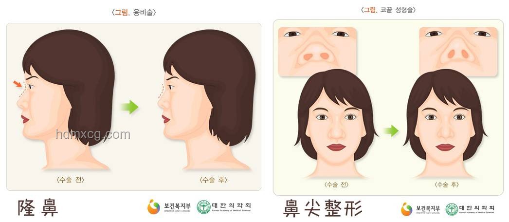 高鼻梁的秘密：解鎖美的標準與自我認知之旅???