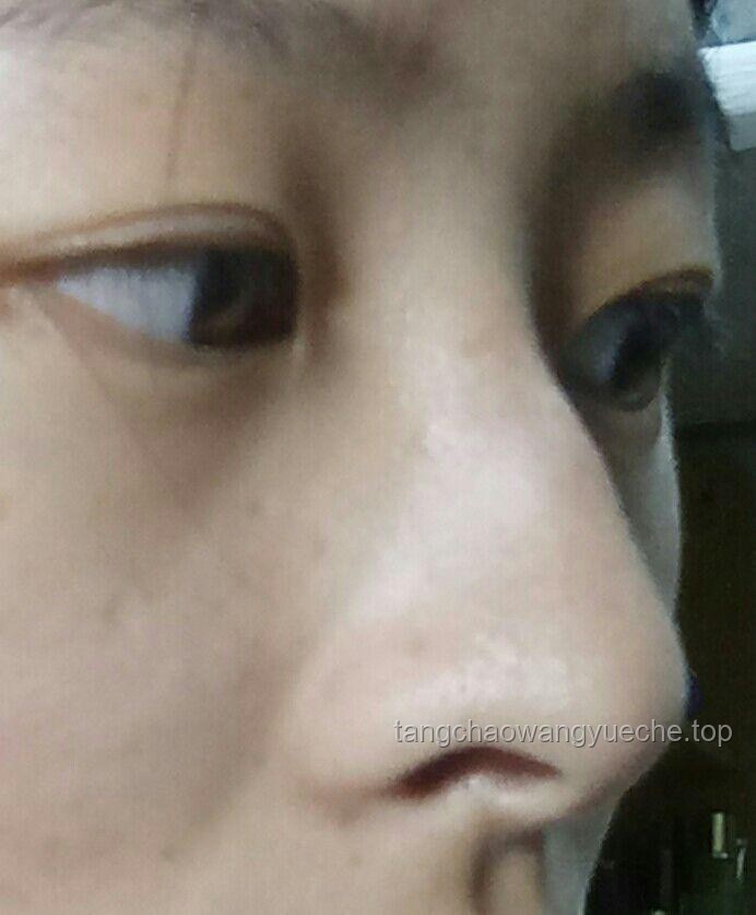 高鼻梁的標(biāo)準(zhǔn)是什么，如何判斷？