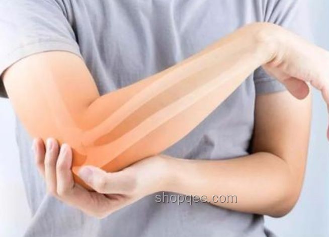 男子掰手腕骨折，慘痛教訓(xùn)分享??骨折，安全，熱身，量力而行