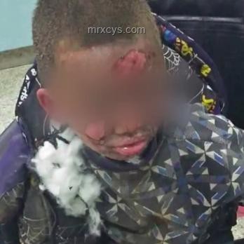 湖南爆炸花炮廠驚魂：趴水溝撿回一條命????