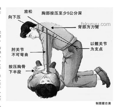 男子運動拉伸致肺動脈栓塞險猝死解決方案