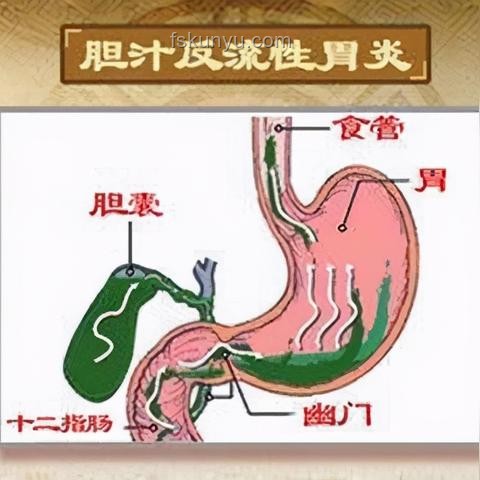 老人誤診胃炎遭全胃切除：醫(yī)療行業(yè)信任危機(jī)與反思