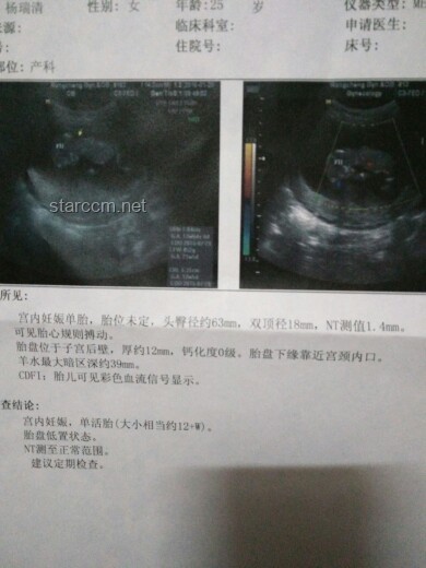 女子腹脹做B超意外誕下男嬰：孕期檢查與應(yīng)對指南