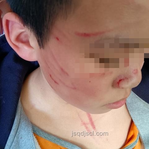 醉酒男子電梯內(nèi)撕扯女孩頭發(fā)事件深度分析