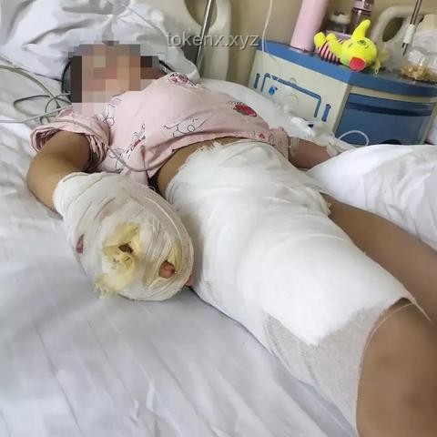 男童遭虐待致輕傷二級(jí)：如何保護(hù)兒童權(quán)益與生父責(zé)任認(rèn)知