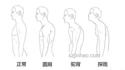 脊柱最喜歡的4個動作解析：保健、預防與康復必備