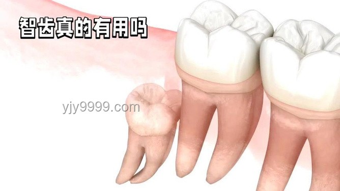 人體之謎：智齒——你身上最沒(méi)用的器官，每天還在拼命工作