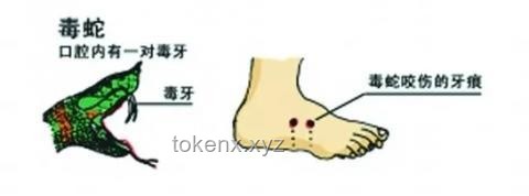 毒蛇咬傷驚魂記：緊急鑒定與凝血危機(jī)????
