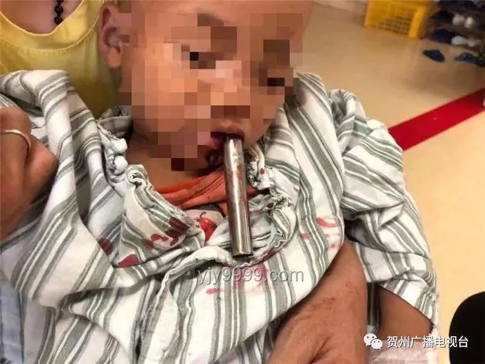 ??3歲男童術(shù)后腦死亡：一次揪心的醫(yī)療經(jīng)歷